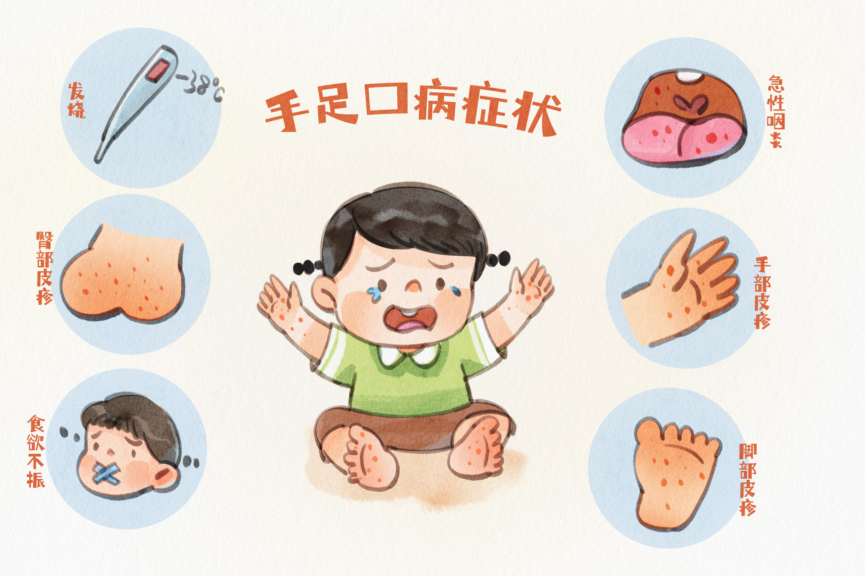 摄图网_403761276_手绘水彩之手足口病症状源插画(企业商用).jpg 摄图网_403761276_手绘水彩之手足口病症状源插画(企业商用).jpg